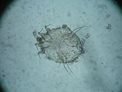 Scabies Mite
